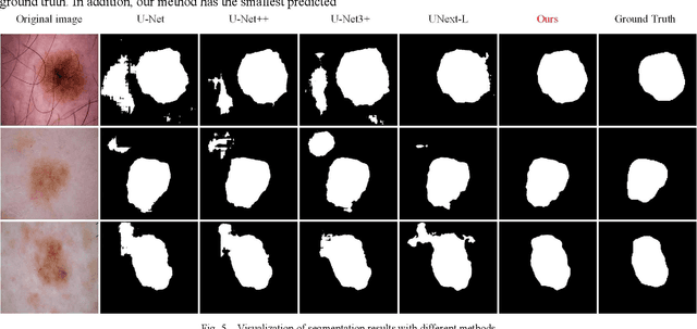 Figure 4 for STM-UNet: An Efficient U-shaped Architecture Based on Swin Transformer and Multi-scale MLP for Medical Image Segmentation