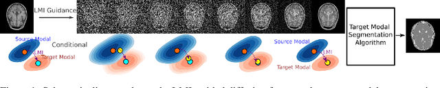 Figure 1 for Diffusion based Zero-shot Medical Image-to-Image Translation for Cross Modality Segmentation