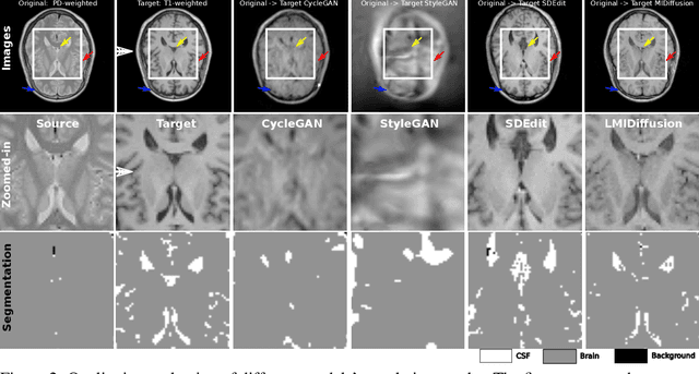 Figure 2 for Diffusion based Zero-shot Medical Image-to-Image Translation for Cross Modality Segmentation