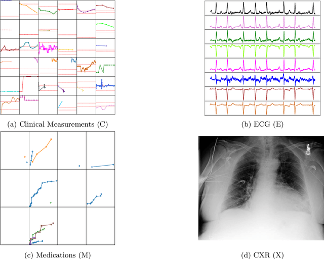 Figure 3 for Arbitrary Data as Images: Fusion of Patient Data Across Modalities and Irregular Intervals with Vision Transformers