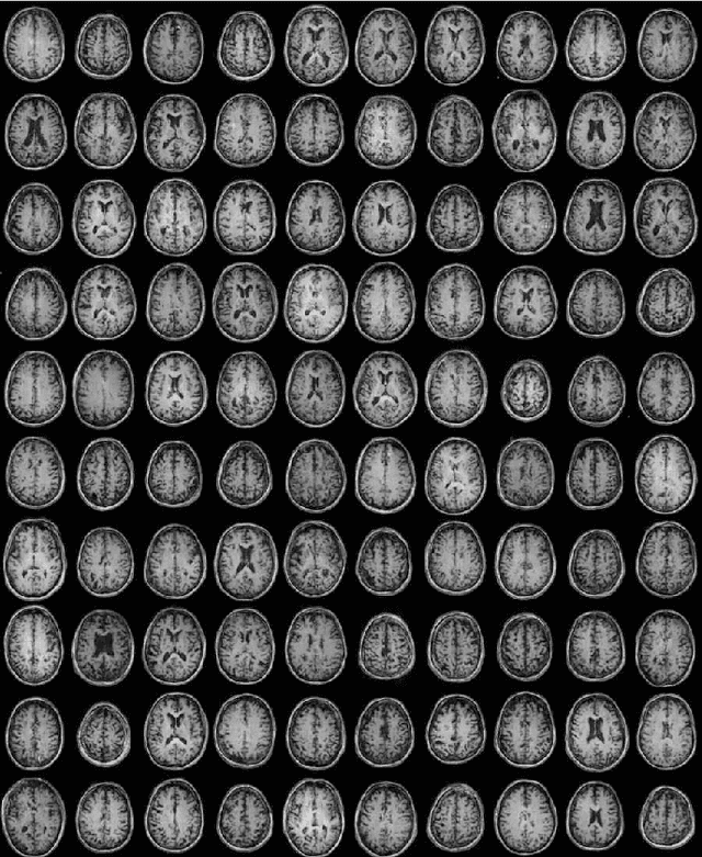 Figure 2 for BlindHarmony: "Blind" Harmonization for MR Images via Flow model