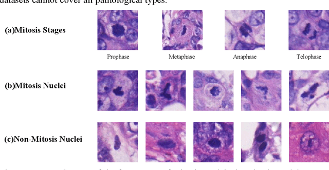 Figure 1 for A novel dataset and a two-stage mitosis nuclei detection method based on hybrid anchor branch