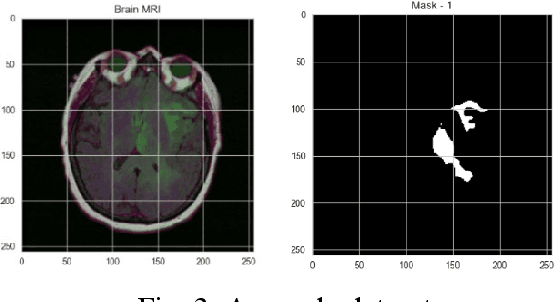 Figure 3 for Residual Connection Networks in Medical Image Processing: Exploration of ResUnet++ Model Driven by Human Computer Interaction