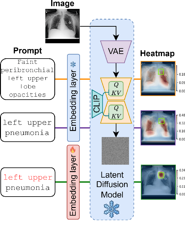 Figure 1 for Anatomy-Grounded Weakly Supervised Prompt Tuning for Chest X-ray Latent Diffusion Models