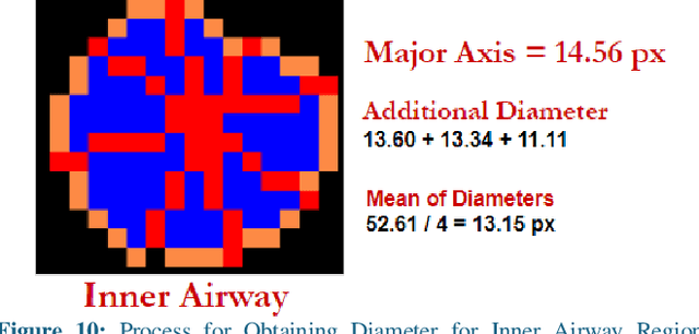 Figure 2 for Methods to Measure the Broncho-Arterial Ratio and Wall Thickness in the Right Lower Lobe for Defining Radiographic Reversibility of Bronchiectasis