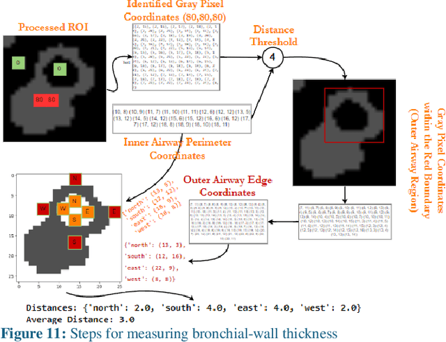 Figure 3 for Methods to Measure the Broncho-Arterial Ratio and Wall Thickness in the Right Lower Lobe for Defining Radiographic Reversibility of Bronchiectasis