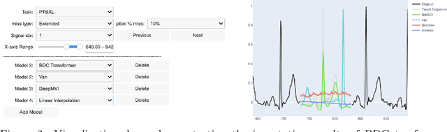 Figure 3 for PyPulse: A Python Library for Biosignal Imputation