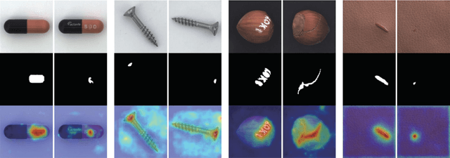 Figure 3 for Multi-scale Feature Imitation for Unsupervised Anomaly Localization