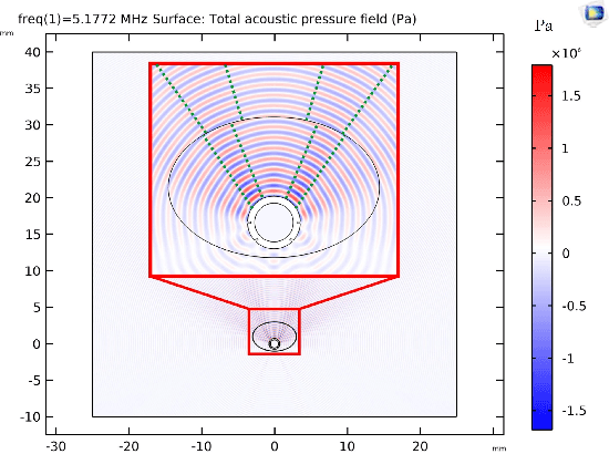 Figure 1 for Development of Advanced FEM Simulation Technology for Pre-Operative Surgical Planning