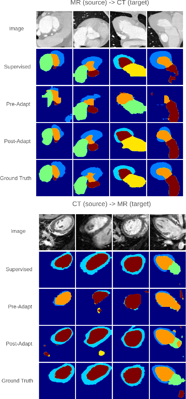 Figure 2 for Cross-Domain Distribution Alignment for Segmentation of Private Unannotated 3D Medical Images