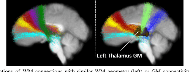 Figure 1 for TractGraphFormer: Anatomically Informed Hybrid Graph CNN-Transformer Network for Classification from Diffusion MRI Tractography