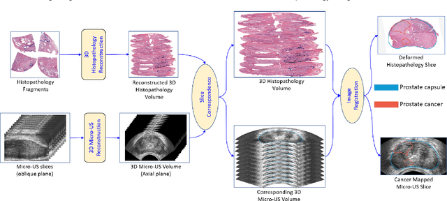 Figure 1 for Image Registration of In Vivo Micro-Ultrasound and Ex Vivo Pseudo-Whole Mount Histopathology Images of the Prostate: A Proof-of-Concept Study