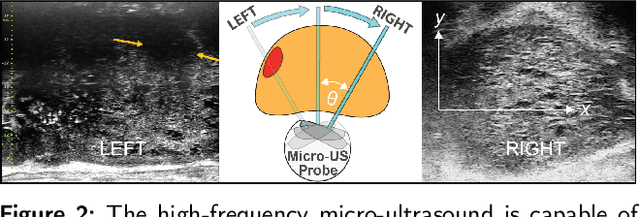 Figure 3 for Image Registration of In Vivo Micro-Ultrasound and Ex Vivo Pseudo-Whole Mount Histopathology Images of the Prostate: A Proof-of-Concept Study