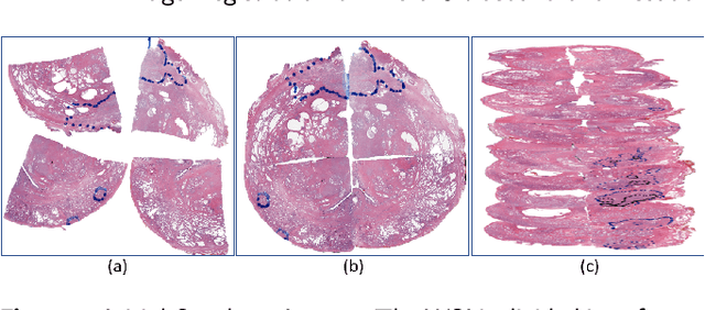 Figure 4 for Image Registration of In Vivo Micro-Ultrasound and Ex Vivo Pseudo-Whole Mount Histopathology Images of the Prostate: A Proof-of-Concept Study