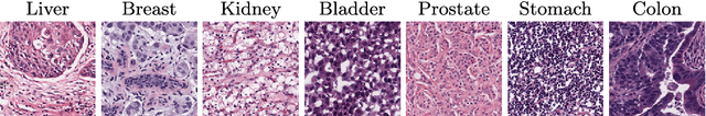 Figure 3 for Improving Generalization Capability of Deep Learning-Based Nuclei Instance Segmentation by Non-deterministic Train Time and Deterministic Test Time Stain Normalization