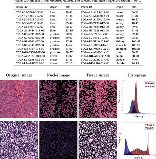 Figure 2 for Improving Generalization Capability of Deep Learning-Based Nuclei Instance Segmentation by Non-deterministic Train Time and Deterministic Test Time Stain Normalization