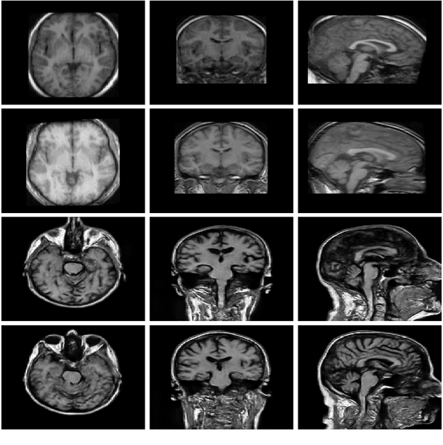 Figure 2 for Non-Reference Quality Assessment for Medical Imaging: Application to Synthetic Brain MRIs