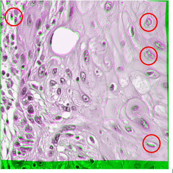 Figure 4 for Nuclei-Location Based Point Set Registration of Multi-Stained Whole Slide Images