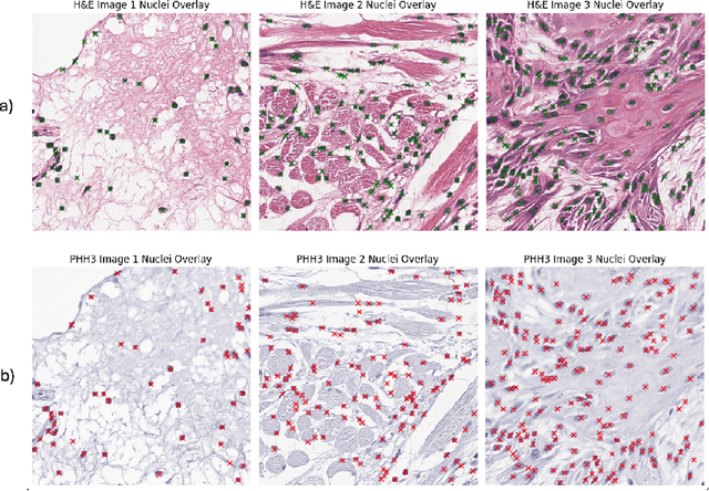 Figure 1 for Nuclei-Location Based Point Set Registration of Multi-Stained Whole Slide Images