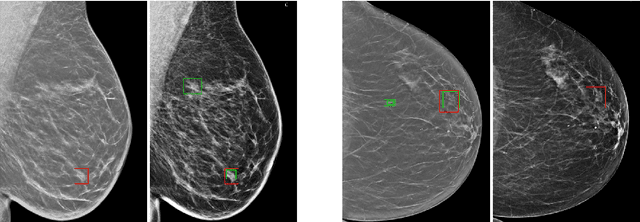 Figure 1 for A training regime to learn unified representations from complementary breast imaging modalities