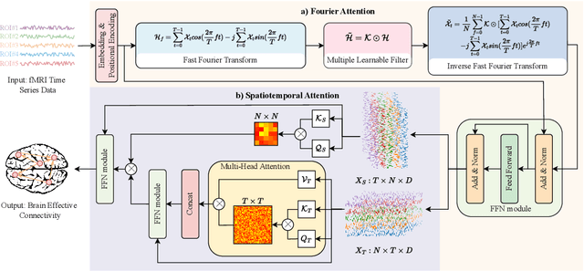 Figure 1 for Brain Effective Connectivity Estimation via Fourier Spatiotemporal Attention