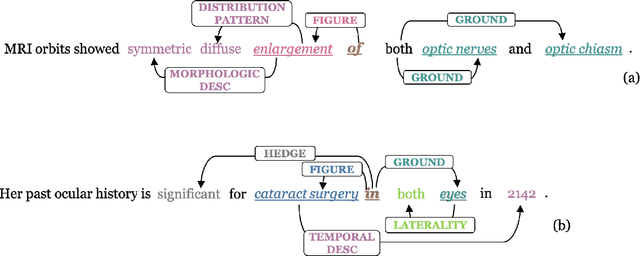 Figure 1 for Eye-SpatialNet: Spatial Information Extraction from Ophthalmology Notes