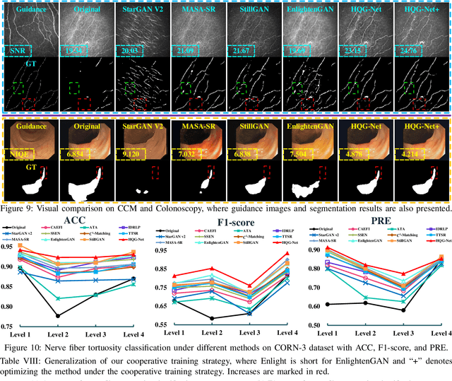 Figure 2 for HQG-Net: Unpaired Medical Image Enhancement with High-Quality Guidance