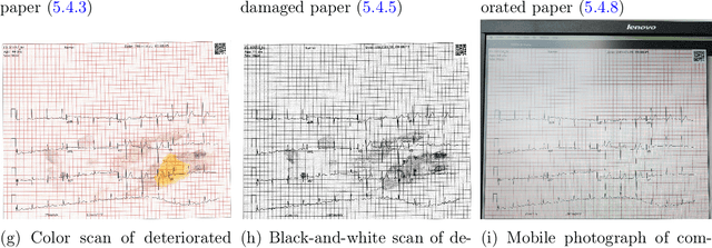 Figure 2 for ECG-Image-Database: A Dataset of ECG Images with Real-World Imaging and Scanning Artifacts; A Foundation for Computerized ECG Image Digitization and Analysis