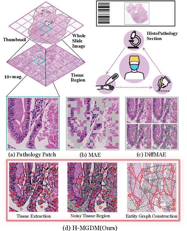 Figure 1 for Dynamic Entity-Masked Graph Diffusion Model for histopathological image Representation Learning