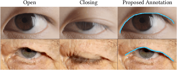 Figure 3 for Eyelid Fold Consistency in Facial Modeling