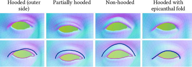 Figure 4 for Eyelid Fold Consistency in Facial Modeling