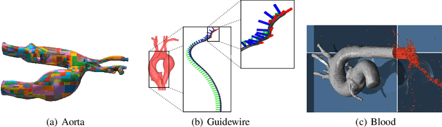 Figure 3 for Autonomous Catheterization with Open-source Simulator and Expert Trajectory