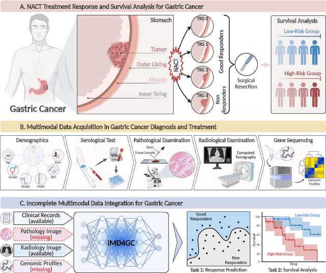 Figure 1 for iMD4GC: Incomplete Multimodal Data Integration to Advance Precise Treatment Response Prediction and Survival Analysis for Gastric Cancer