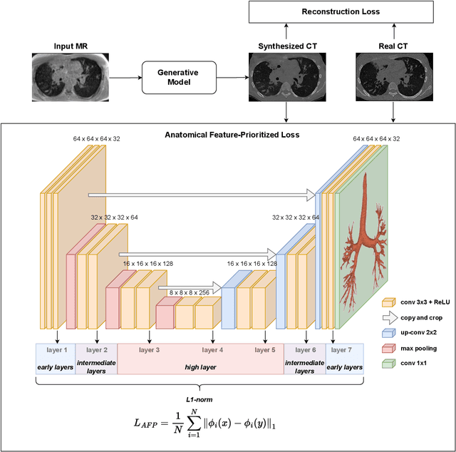 Figure 1 for Anatomical feature-prioritized loss for enhanced MR to CT translation