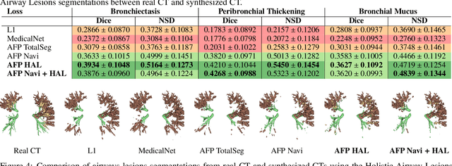 Figure 4 for Anatomical feature-prioritized loss for enhanced MR to CT translation