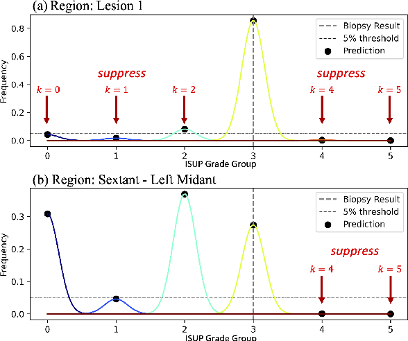 Figure 2 for Mixed Supervision of Histopathology Improves Prostate Cancer Classification from MRI