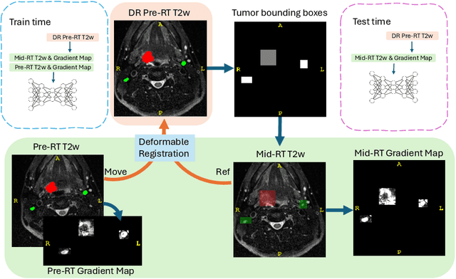 Figure 1 for Gradient Map-Assisted Head and Neck Tumor Segmentation: A Pre-RT to Mid-RT Approach in MRI-Guided Radiotherapy