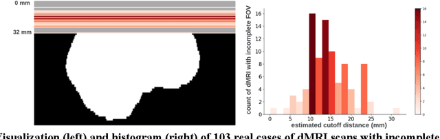 Figure 1 for Field-of-View Extension for Diffusion MRI via Deep Generative Models