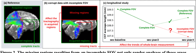 Figure 3 for Field-of-View Extension for Diffusion MRI via Deep Generative Models