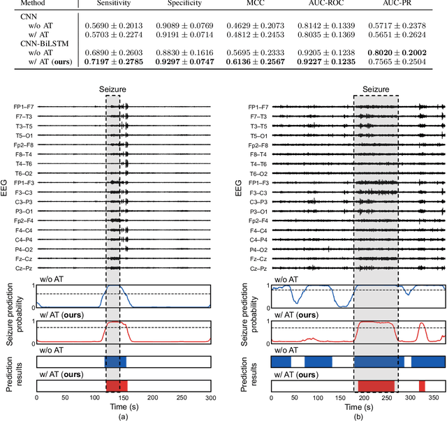 Figure 3 for EEG-Based Inter-Patient Epileptic Seizure Detection Combining Domain Adversarial Training with CNN-BiLSTM Network