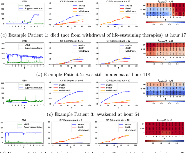 Figure 3 for Neurological Prognostication of Post-Cardiac-Arrest Coma Patients Using EEG Data: A Dynamic Survival Analysis Framework with Competing Risks