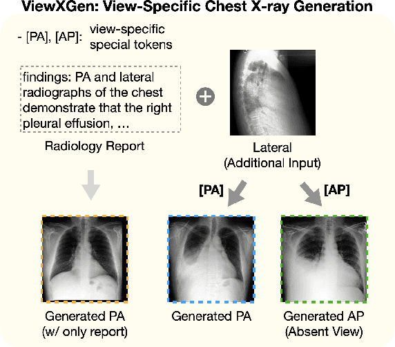 Figure 1 for Unified Chest X-ray and Radiology Report Generation Model with Multi-view Chest X-rays