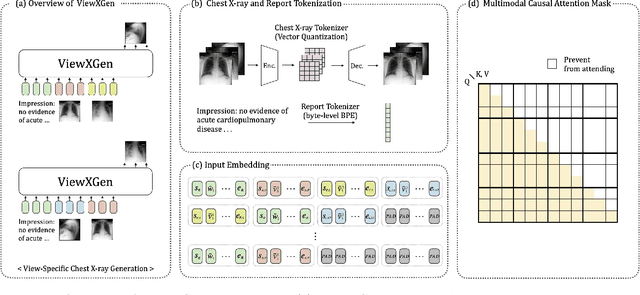 Figure 3 for Unified Chest X-ray and Radiology Report Generation Model with Multi-view Chest X-rays