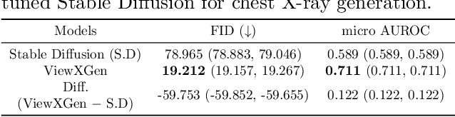 Figure 4 for Unified Chest X-ray and Radiology Report Generation Model with Multi-view Chest X-rays