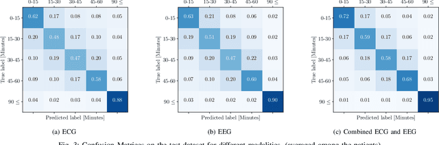 Figure 3 for A Multi-Modal Non-Invasive Deep Learning Framework for Progressive Prediction of Seizures