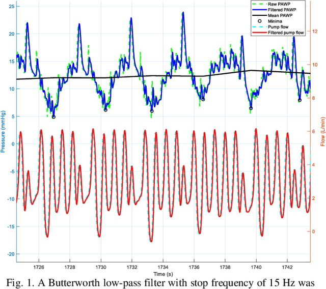 Figure 1 for Fully Elman Neural Network: A Novel Deep Recurrent Neural Network Optimized by an Improved Harris Hawks Algorithm for Classification of Pulmonary Arterial Wedge Pressure
