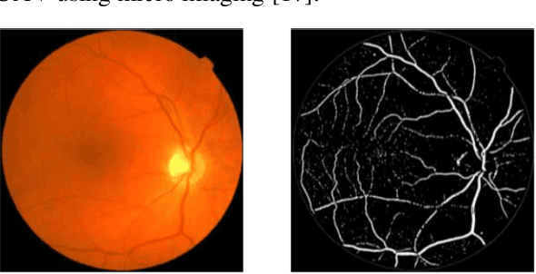 Figure 3 for PhyCV: The First Physics-inspired Computer Vision Library