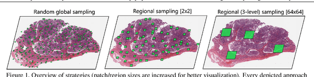 Figure 1 for Towards Hierarchical Regional Transformer-based Multiple Instance Learning