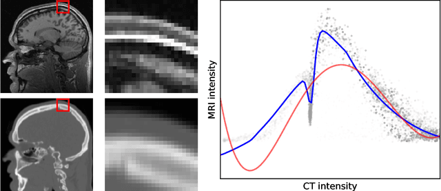 Figure 1 for New multimodal similarity measure for image registration via modeling local functional dependence with linear combination of learned basis functions
