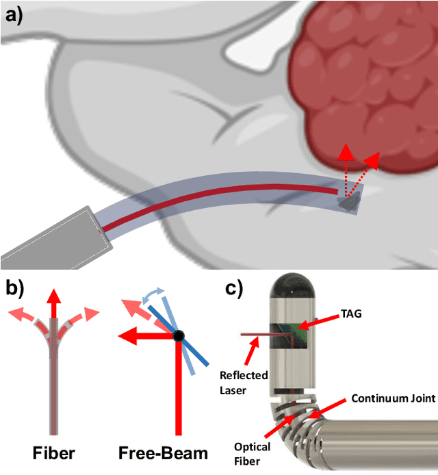 Figure 1 for Towards the Development of a Tendon-Actuated Galvanometer for Endoscopic Surgical Laser Scanning